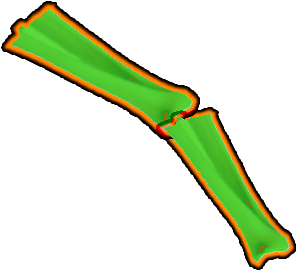 arm_right